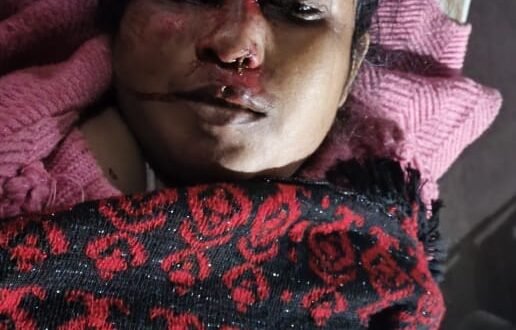 कंबाइन मशीन की चपेट में आए बाइक सवार दंपती, पत्नी की मौत, पति गंभीर